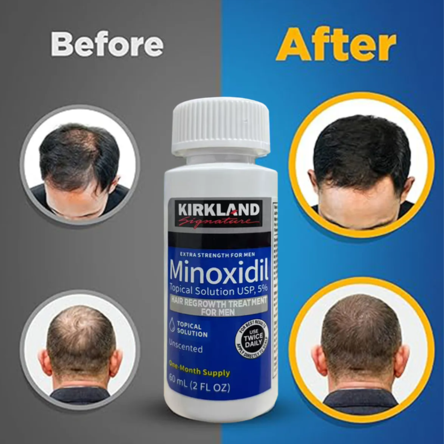 Minoxidil Kirkland Caja 6 Unds Crecimiento Cabello Ups 5%